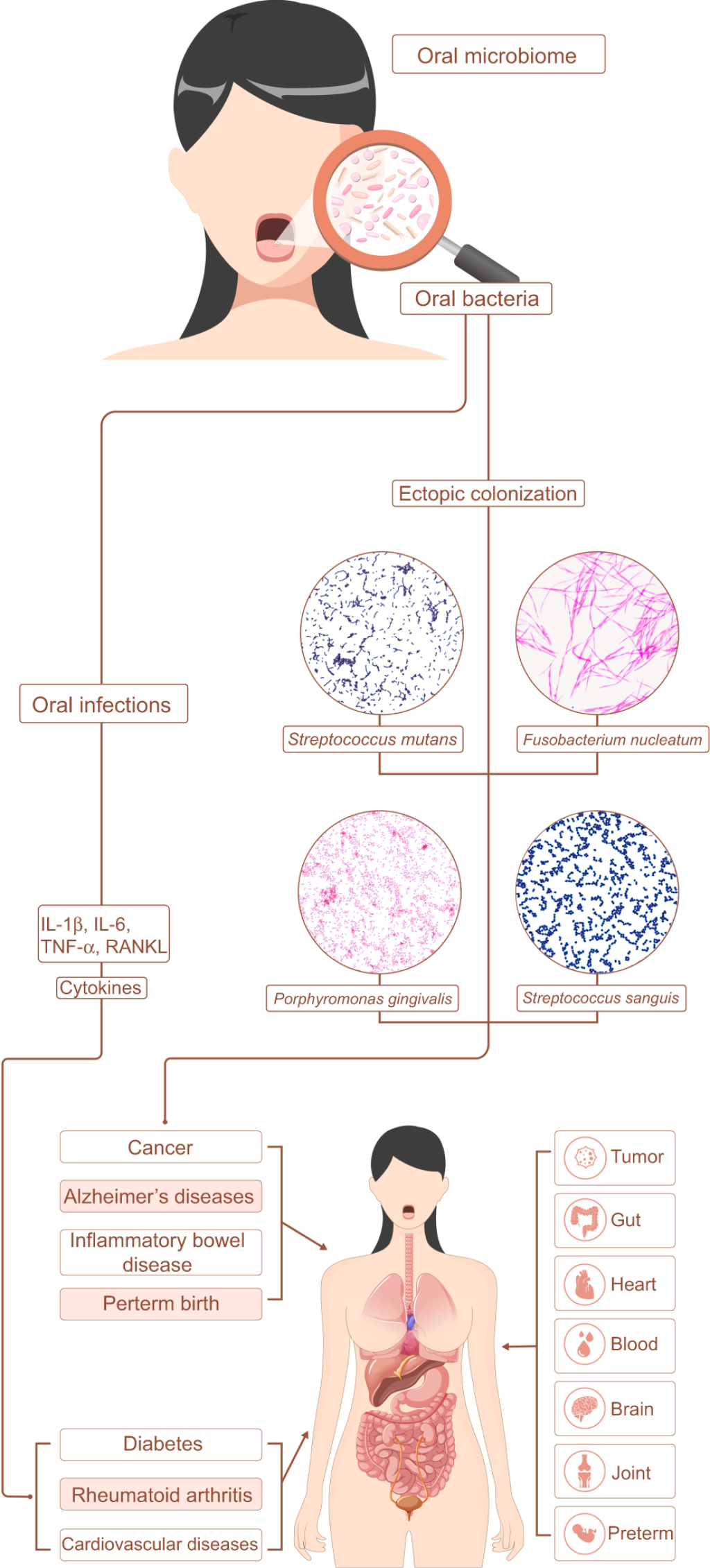 Picture of: Oral microbiota in human systematic diseases  International