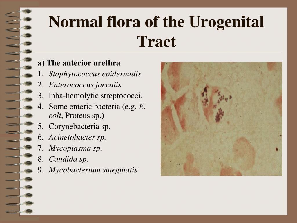 Picture of: What Is Mixed Urogenital Flora?
